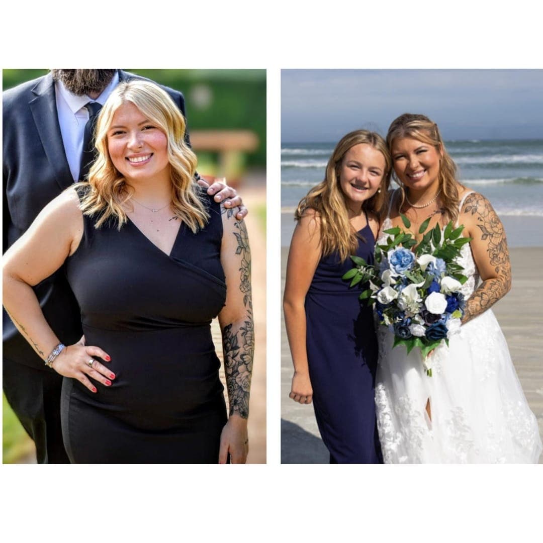 Hannah before and after